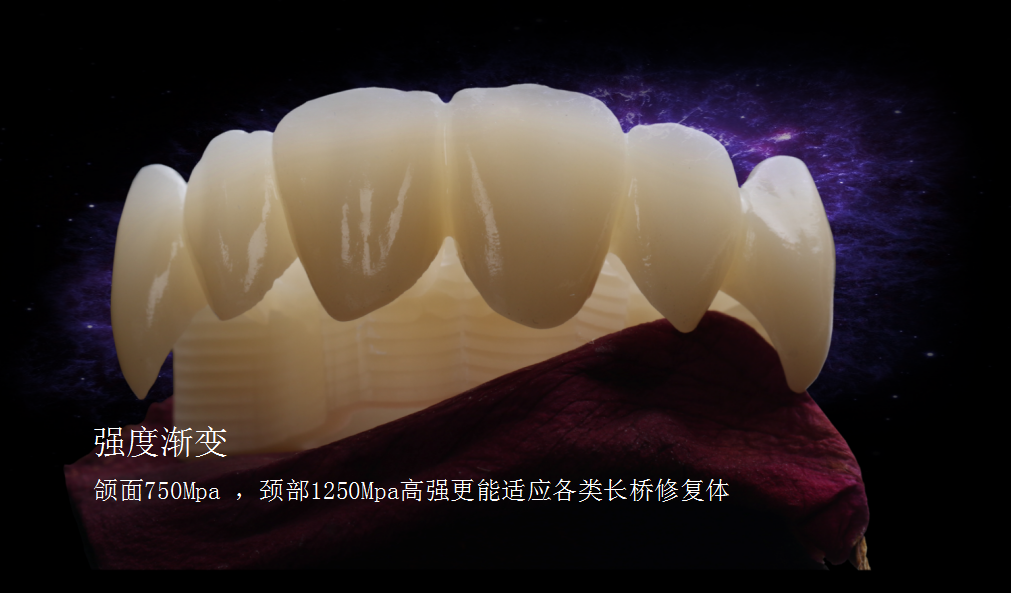 XTCERA 3D Multilayer 