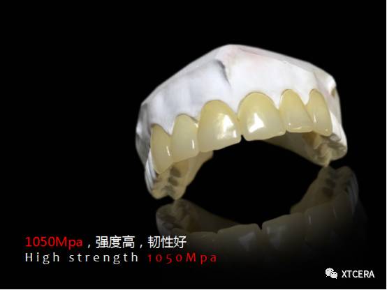 微笑中国,我们在行动 |翔通&维美——全瓷美学修复会议圆满收官 微笑中国,我们在行动 |翔通&维美——全瓷美学修复会议圆满收官