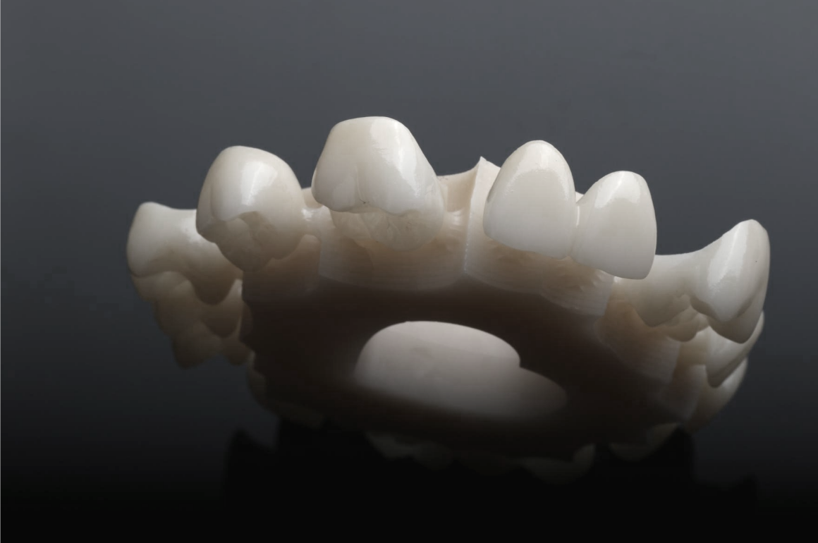 XTCERA 3D White 