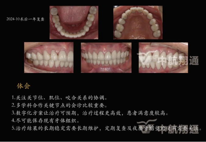 多学科联合治疗重度磨耗咬合重建⼀例