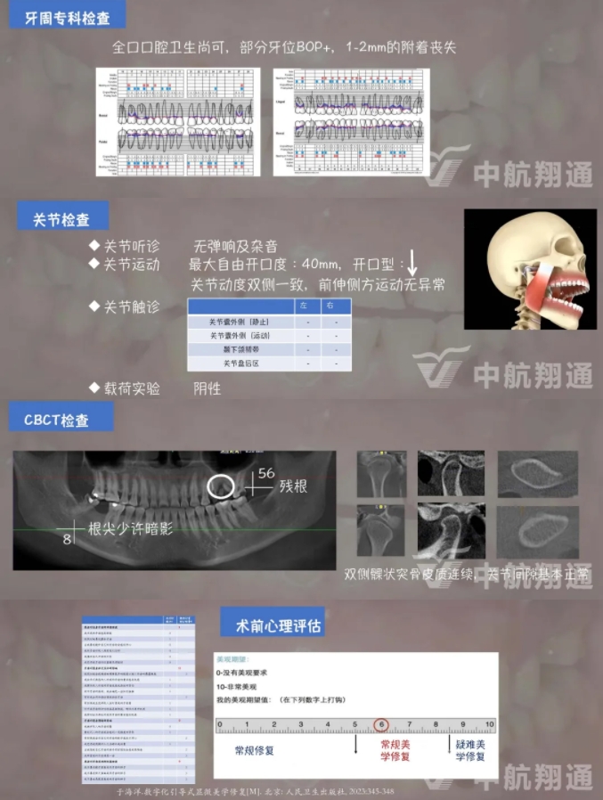 2024华人美学临床病例大赛获奖病例|数字化辅助牙列重度磨耗的美学和功能重建一例