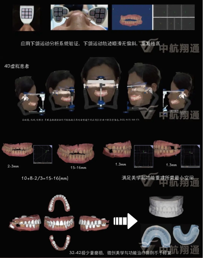2024华人美学临床病例大赛获奖病例|数字化辅助牙列重度磨耗的美学和功能重建一例