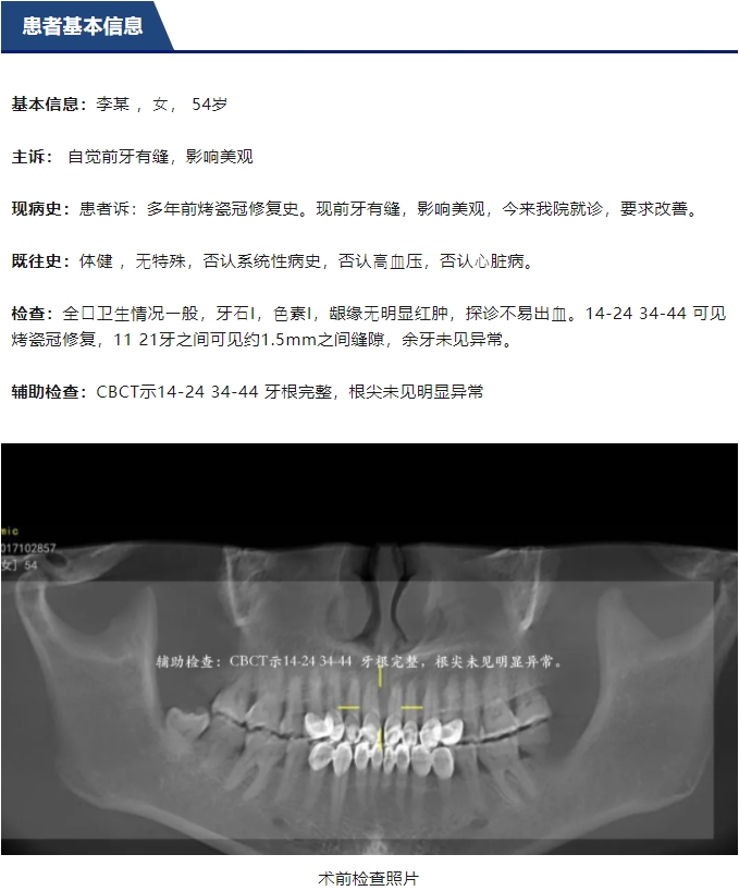 前牙全瓷美学修复临床病例分享