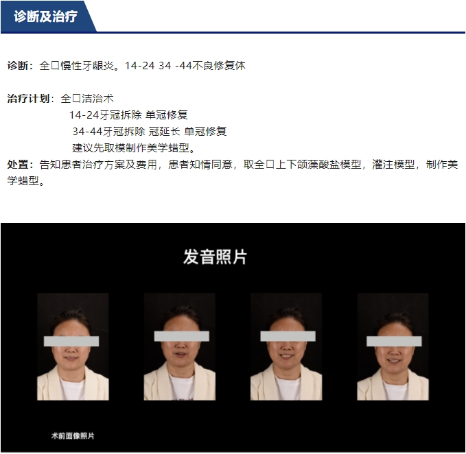 前牙全瓷美学修复临床病例分享