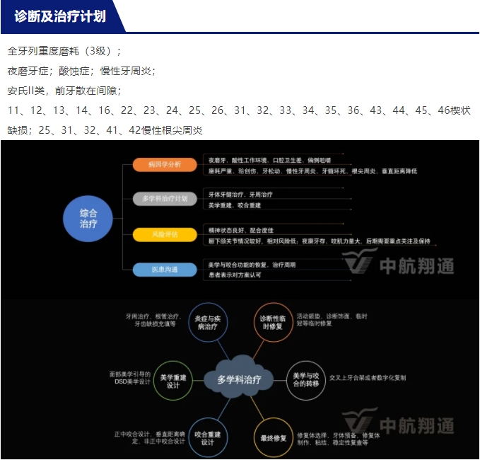 2024华人美学临床病例大赛获奖病例|以美学设计为导向的牙列重度磨耗患者全牙列咬合重建
