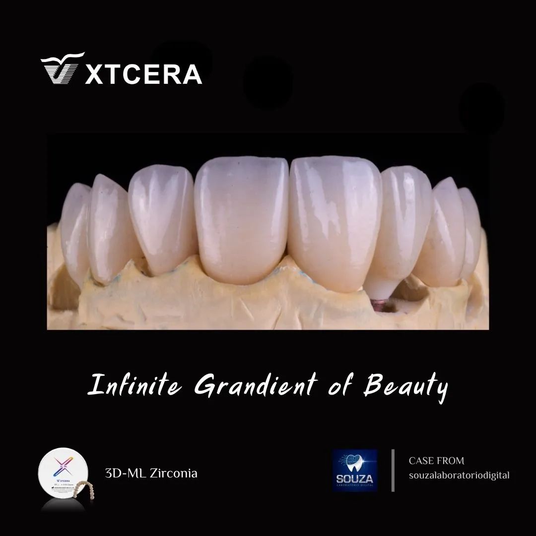 中航翔通3D ML Zirconia|匠心臻选·定制级美学修复