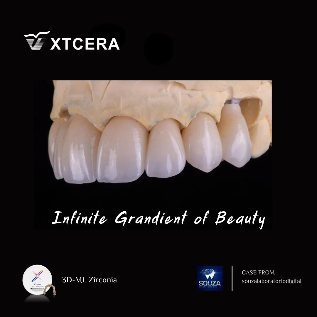 中航翔通3D ML Zirconia|匠心臻选·定制级美学修复