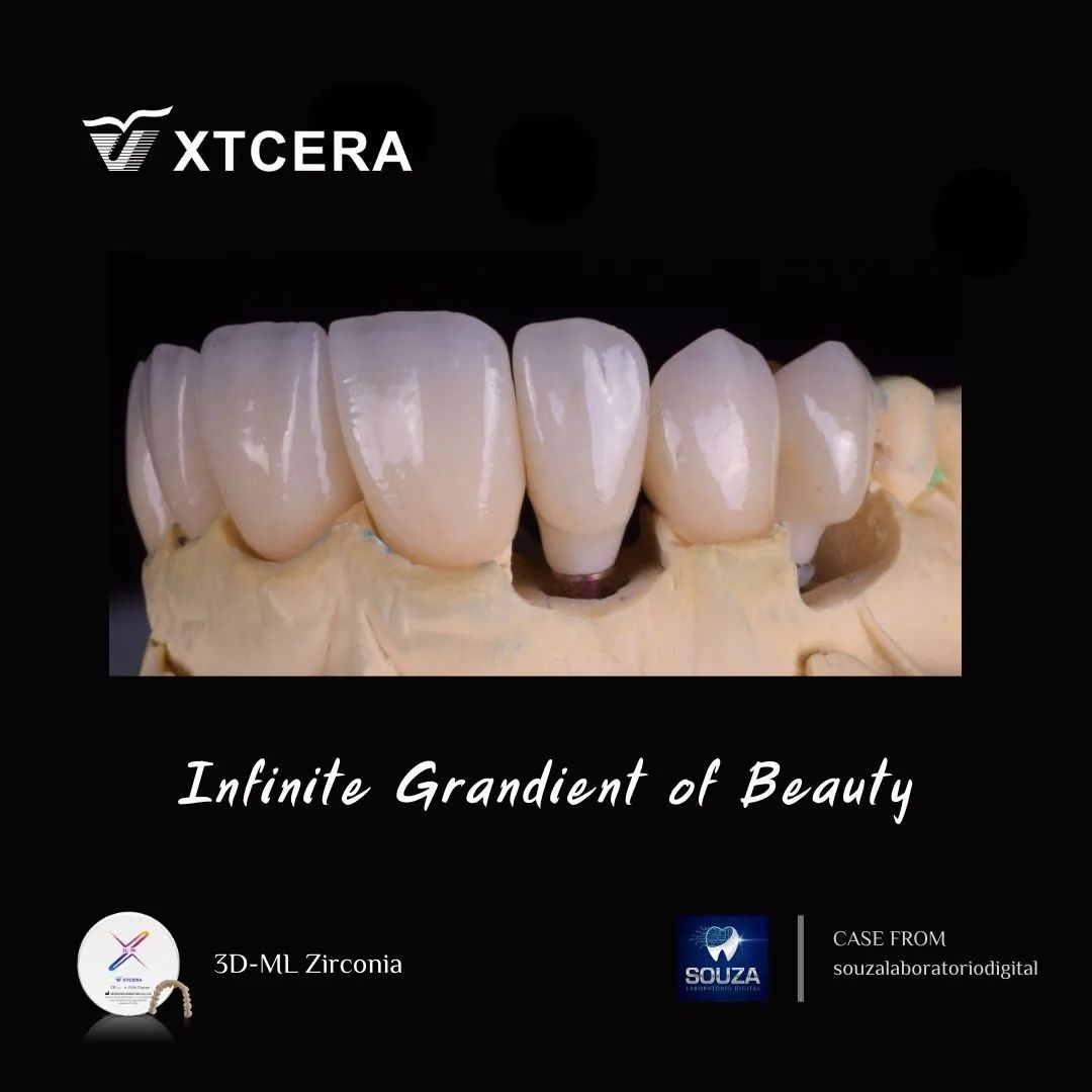 中航翔通3D ML Zirconia|匠心臻选·定制级美学修复