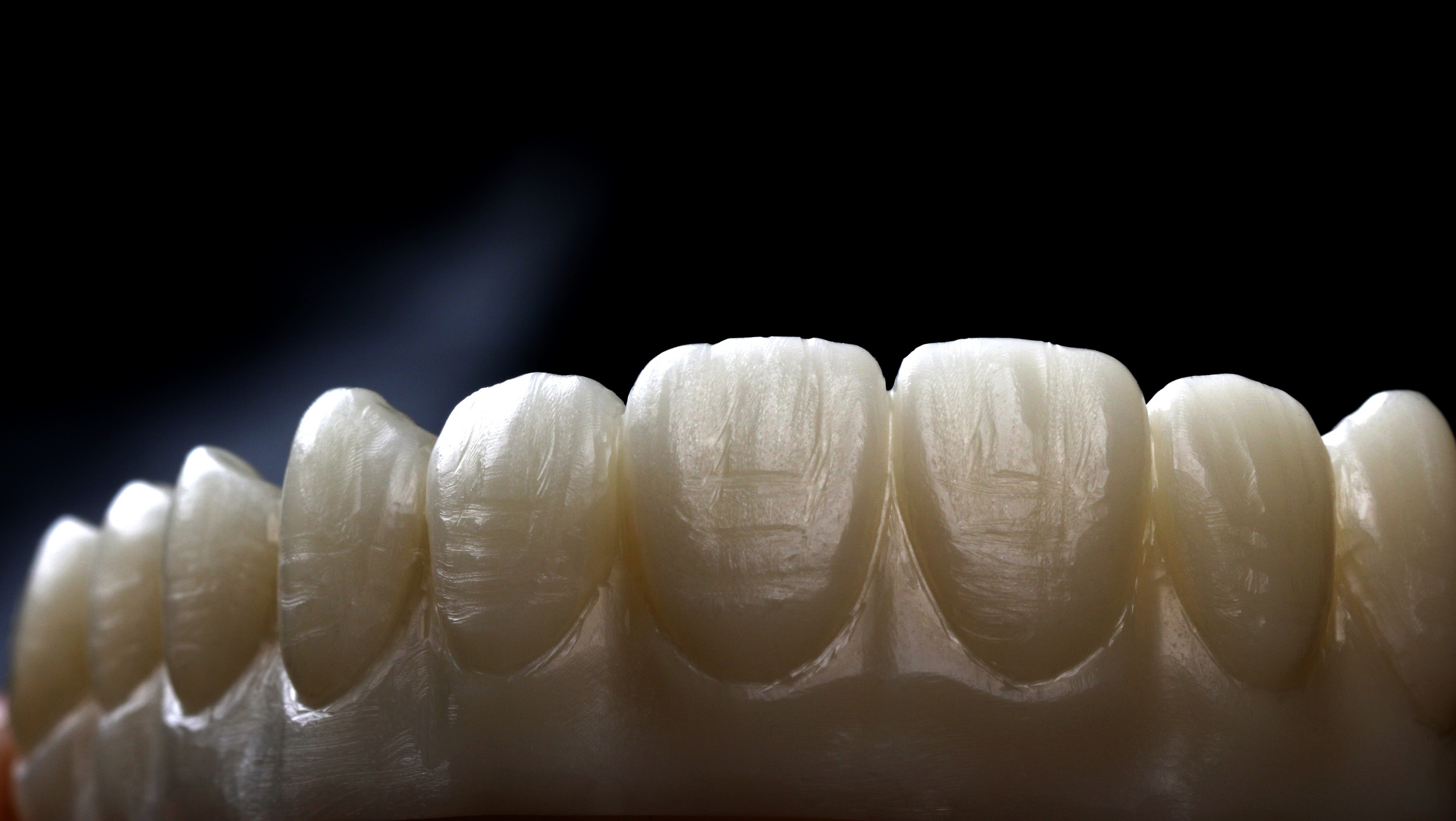 目前上海常见的全瓷牙都有哪几种-欣美整形网